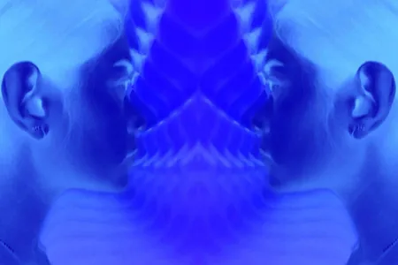 XRAY Webpost 200610 1 DN 6